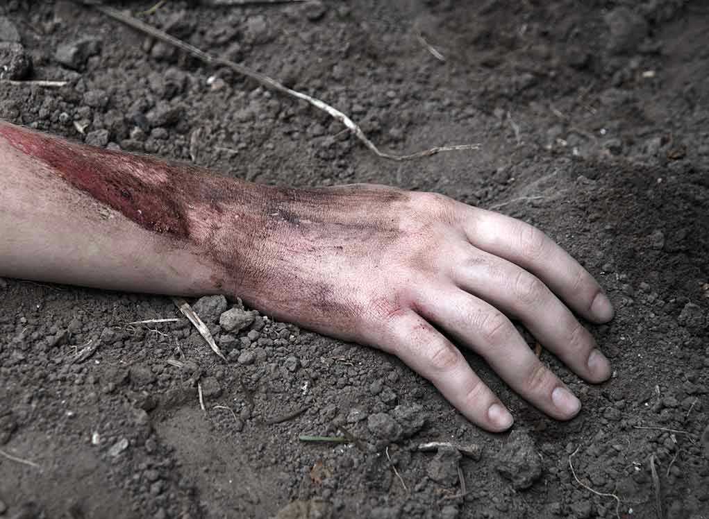 Injured arm partially buried in dirt.
