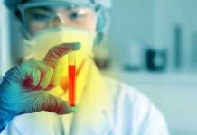 Scientist holding a test tube with red liquid in a laboratory setting
