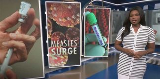 Measles cases in the U.S. SURGE to 35-year high