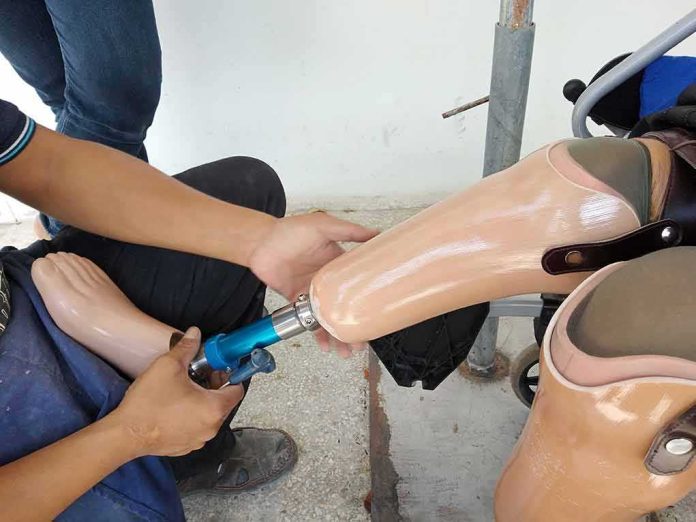 shutterstock_1293680050-1 Technician adjusting a prosthetic leg on a seated person