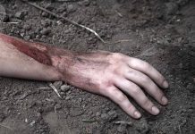 Injured arm partially buried in dirt
