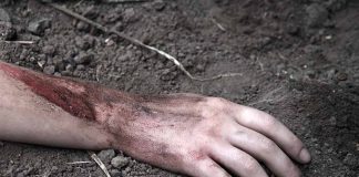 Injured arm partially buried in dirt