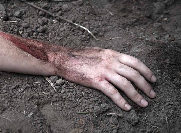 2264420079 featured image Injured arm partially buried in dirt